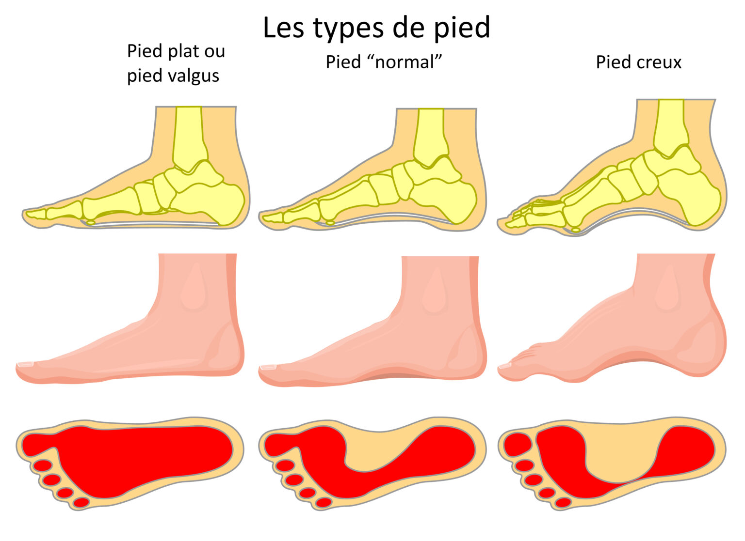 Combien Coute Une Photo De Pieds Le louedec | LES DIFFÉRENTS TYPES DE PIED