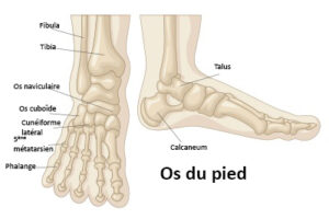 Le Louedec | FRACTURES DE FATIGUE (= DE STRESS)